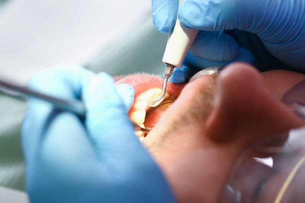 Best Emergency Dental Services for Seniors in Draper, UT