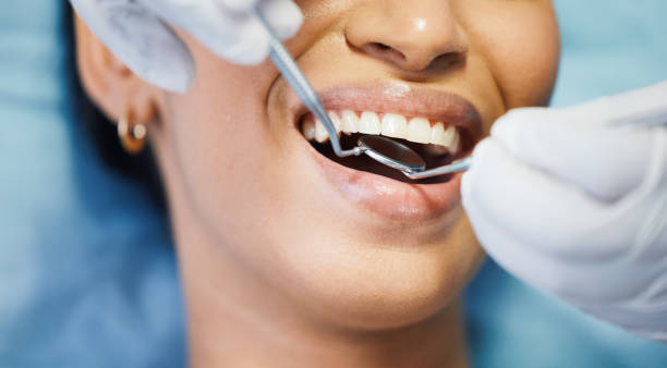 Best Broken or Cracked Tooth Emergency Dentist in Draper, UT